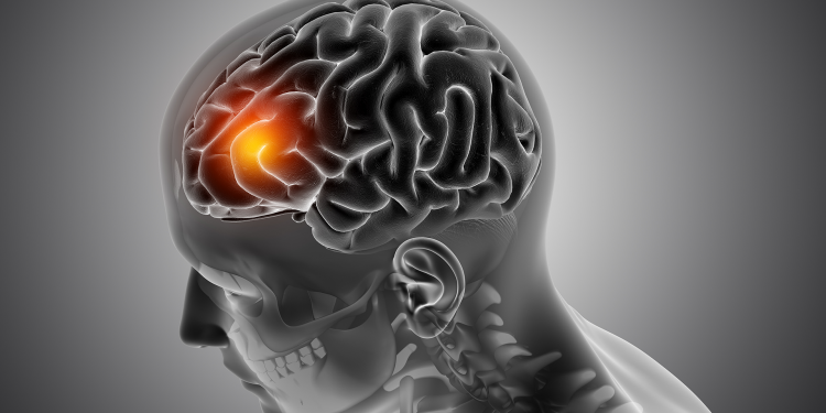 sports-related injuries, health of athletes