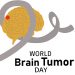 Tumor Day, research and treatment