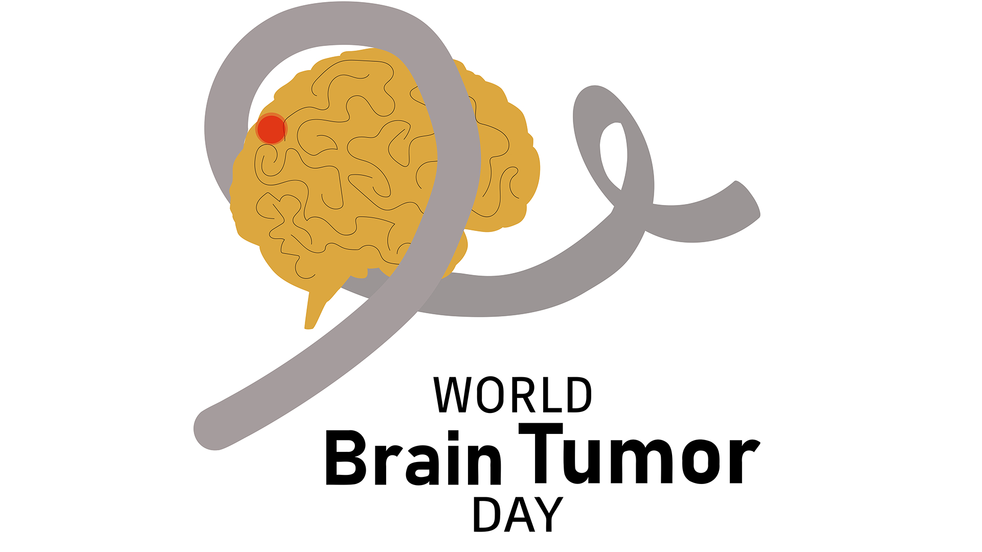 Tumor Day, research and treatment
