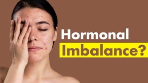 Hormonal imbalance, hormonal imbalances signs, hormonal imbalance female symptoms, hormonal imbalance in woman, Hormonal imbalance in man,