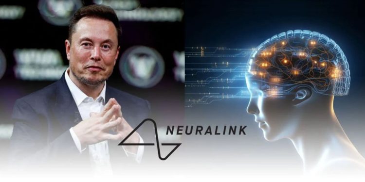 Brain-machine interface, Brain Implant Neuralink, brain-machine interface technology,