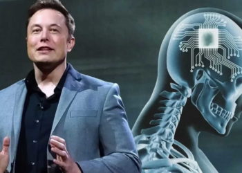 Brain-computer interface, brain-chip technology, brain-chip, medical technology