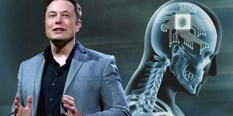 Brain-computer interface, brain-chip technology, brain-chip, medical technology