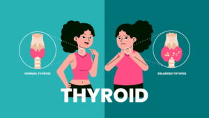 Exhaustion and thyroid, hypothyroidism treatment, hypothyroidism causes, symptoms of hyperthyroidism, health first