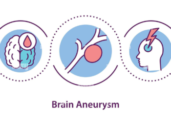 Brain aneurysm, Brain aneurysm symptoms, Brain aneurysm causes, Brain aneurysm how does it happen, can you survive a Brain aneurysm